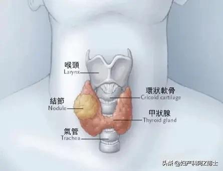 孕期查出甲减，会影响胎儿智力吗？