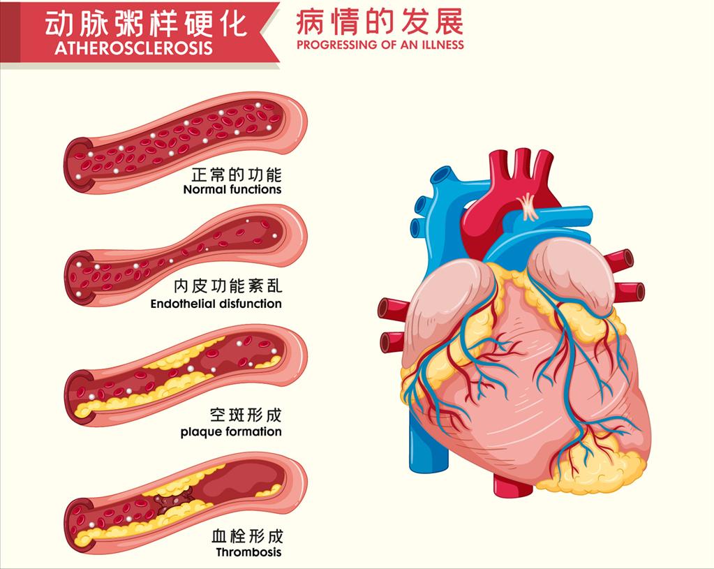 抽烟会影响血管堵塞和血压升高吗？