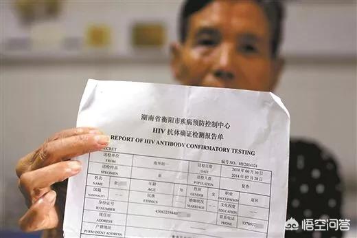 hiv阳性一定是艾滋病吗?