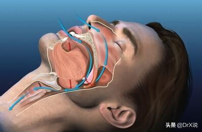 打呼噜是怎么回事？