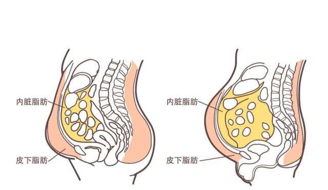 肚子上赘肉比较多应该如何健身减肥呢？