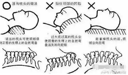 富贵包怎么消除？