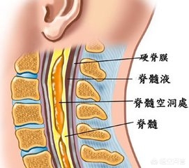 富贵包怎么消除？